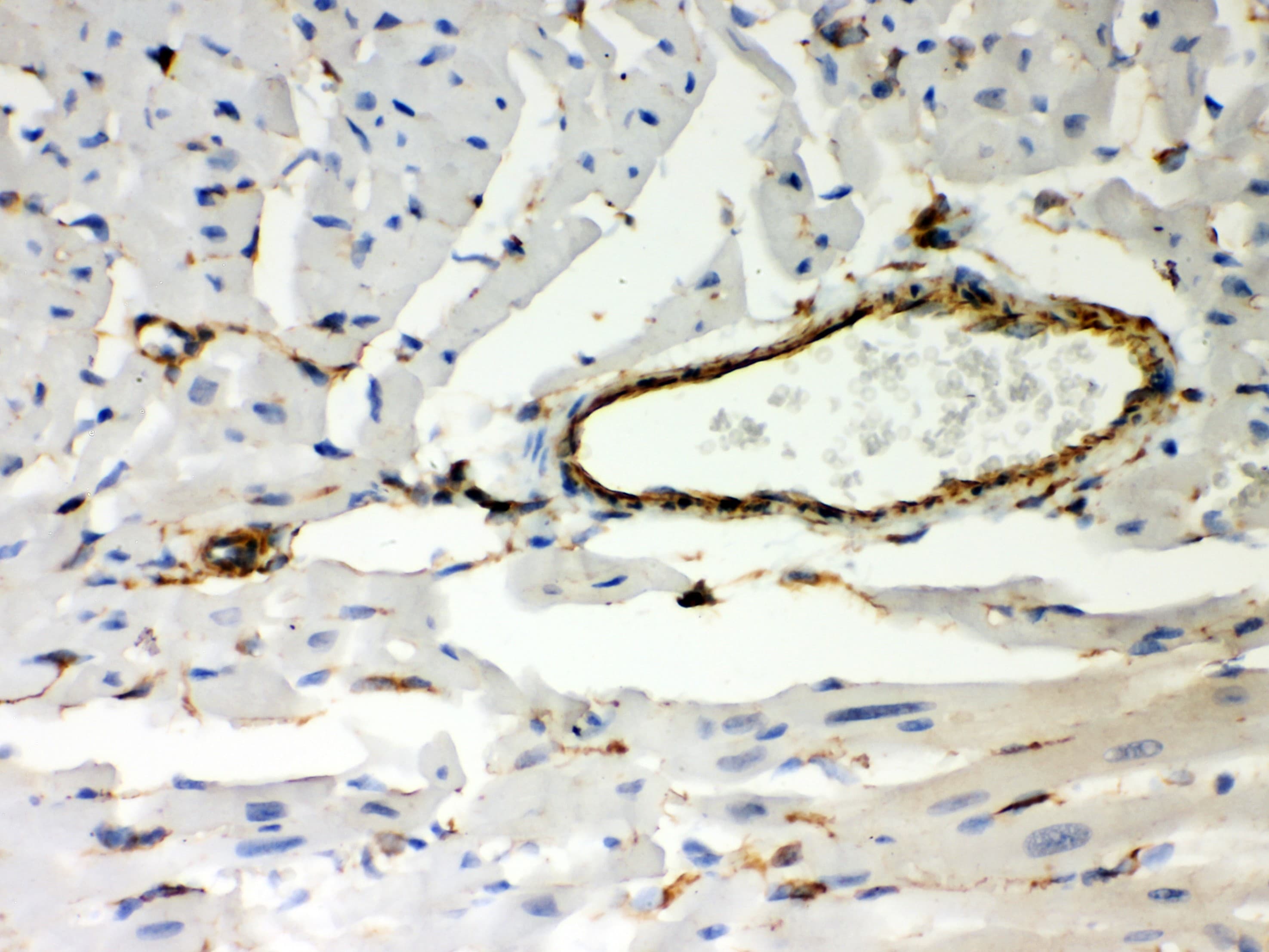 Polyclonal Rabbit anti-Human Vimentin Antibody (aa435-466, IHC, WB)