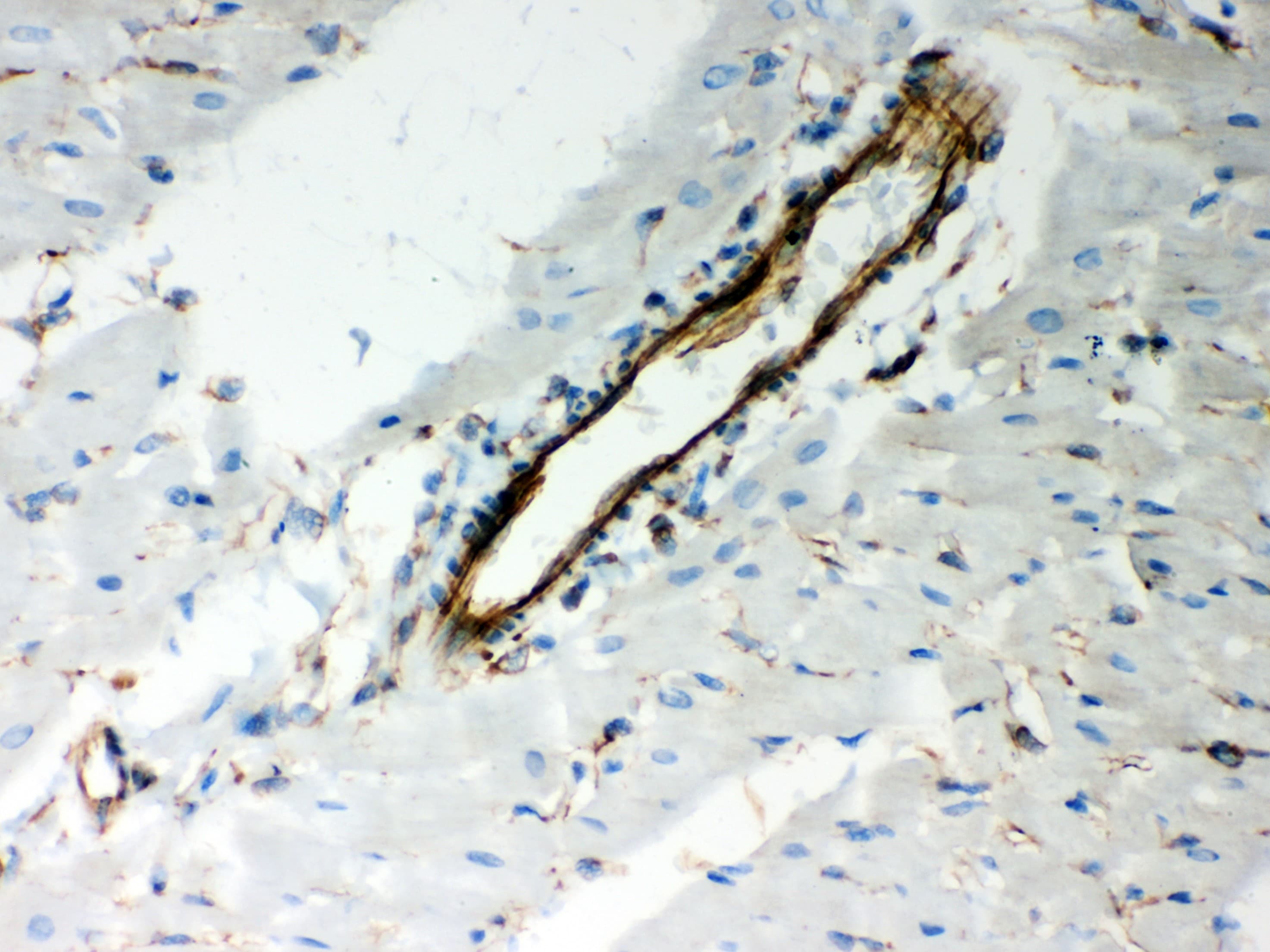 Polyclonal Rabbit anti-Human Vimentin Antibody (aa435-466, IHC, WB)
