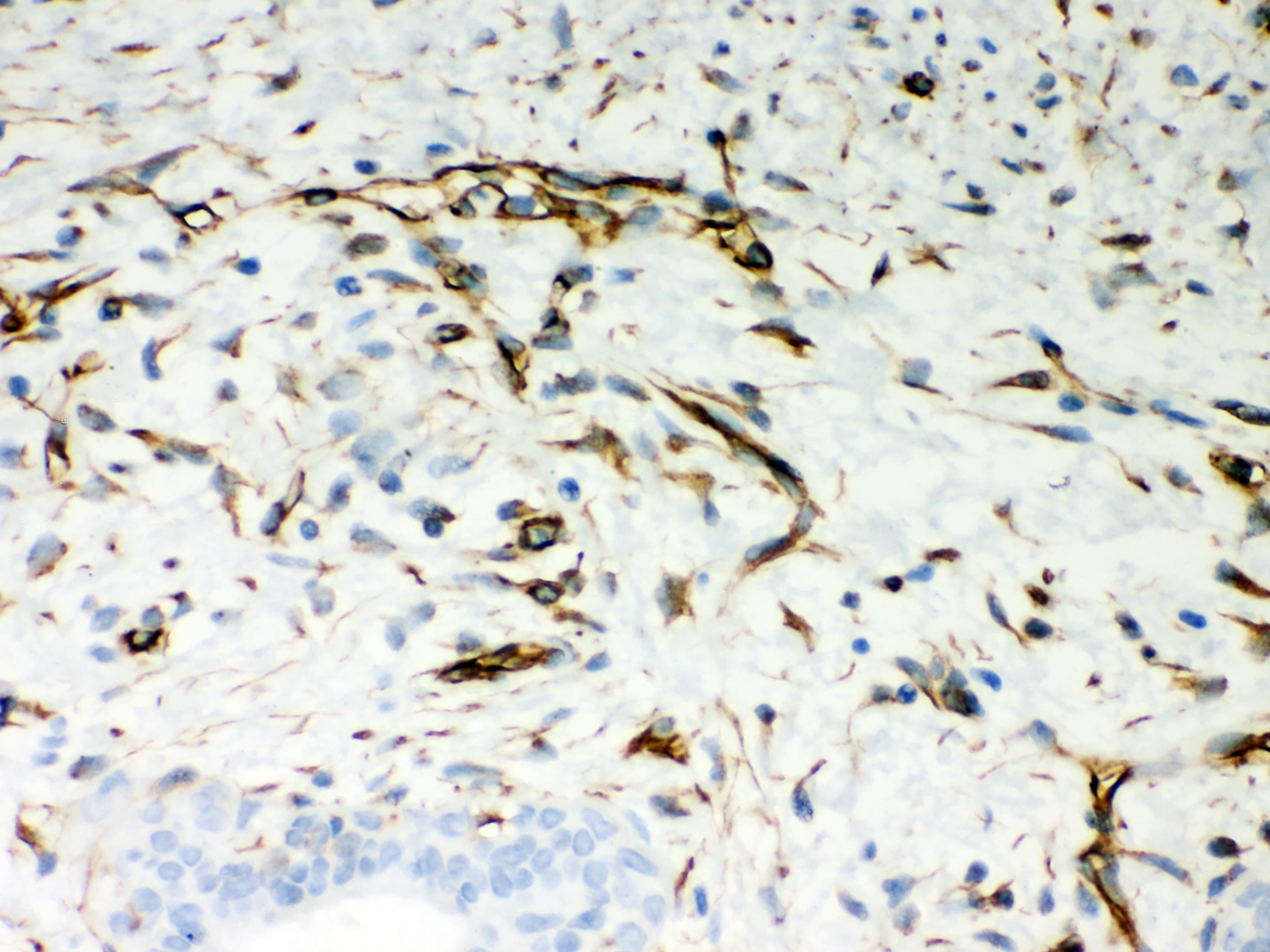 Polyclonal Rabbit anti-Human Vimentin Antibody (aa435-466, IHC, WB)