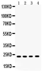Polyclonal Rabbit anti-Human RBP4 Antibody (WB)