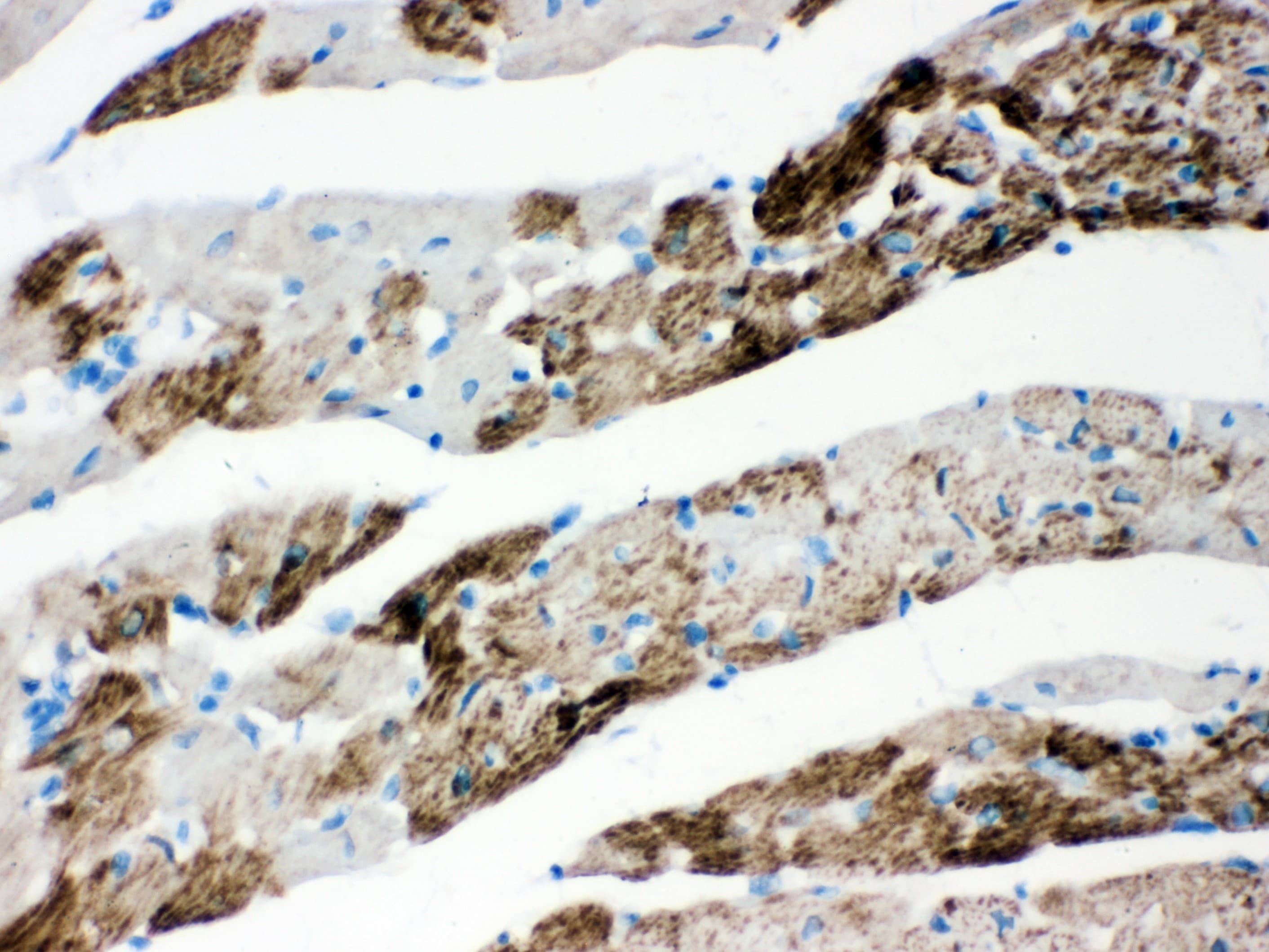 AIFM1 / AIF / PDCD8 Antibody (aa582-613)