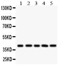 Polyclonal Rabbit anti-Human HLA-C Antibody (aa38-62, IHC, WB)