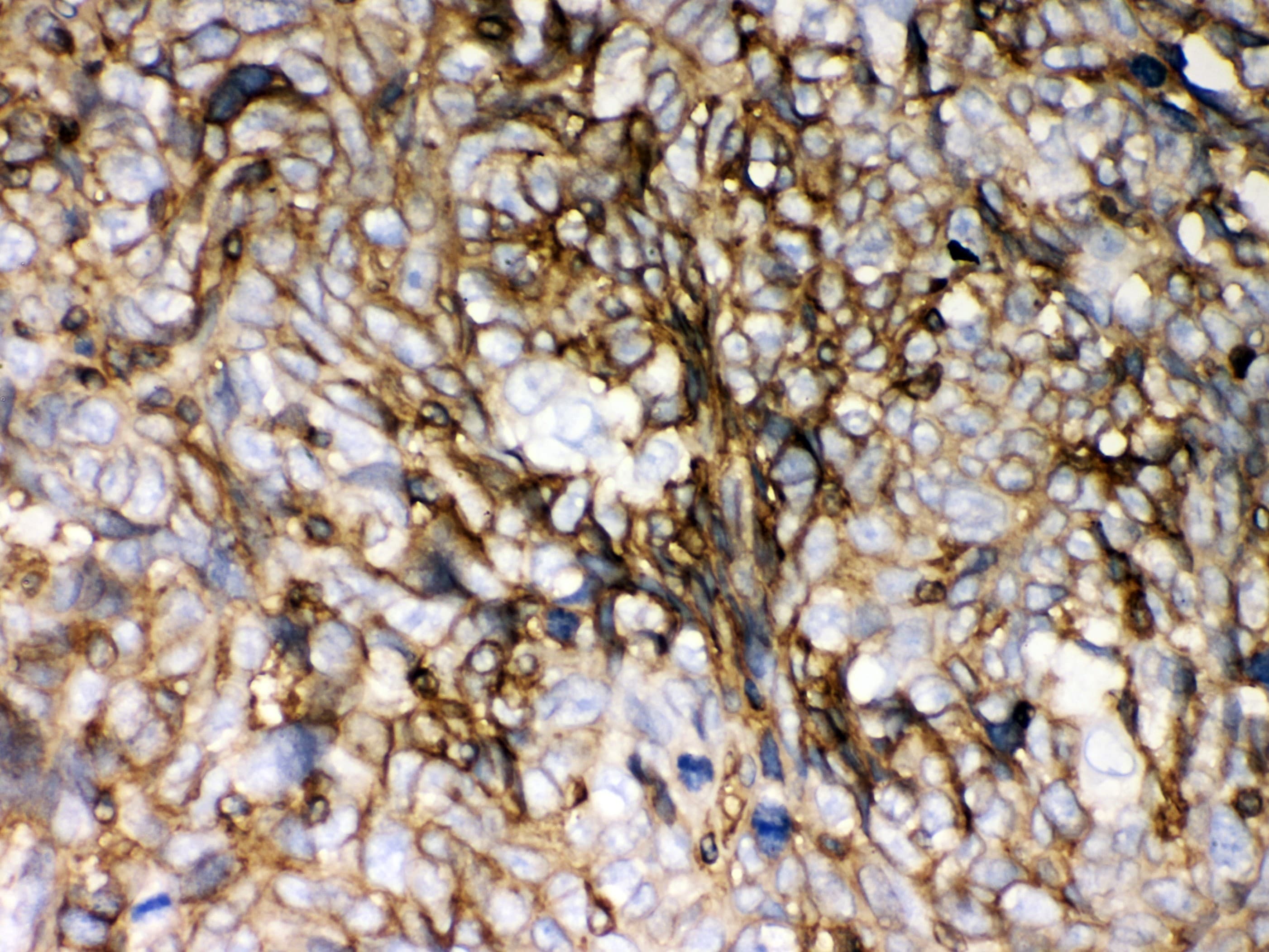 Polyclonal Rabbit anti-Human HLA-C Antibody (aa38-62, IHC, WB)
