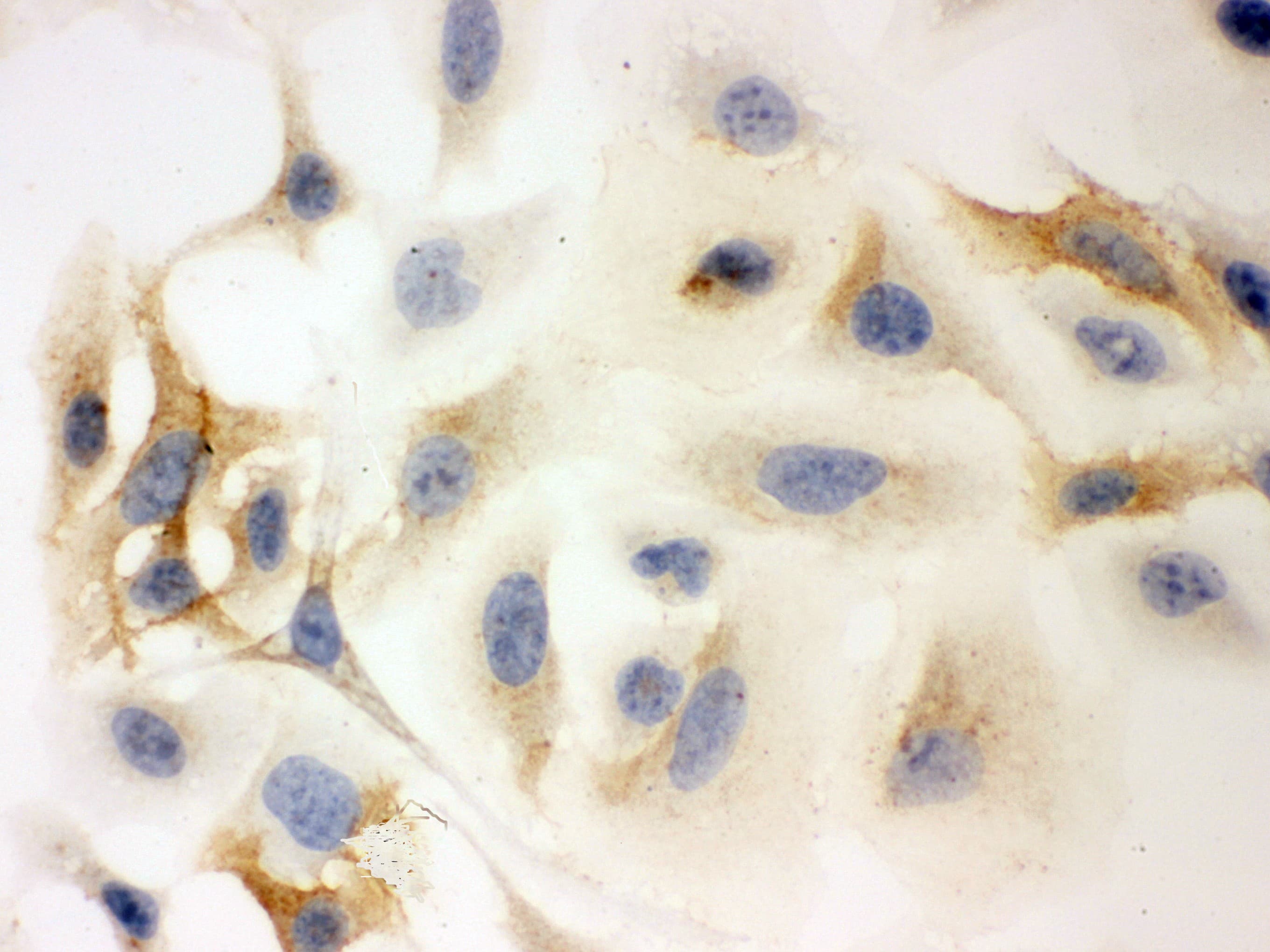 Polyclonal Rabbit anti-Human HLA-C Antibody (aa38-62, IHC, WB)