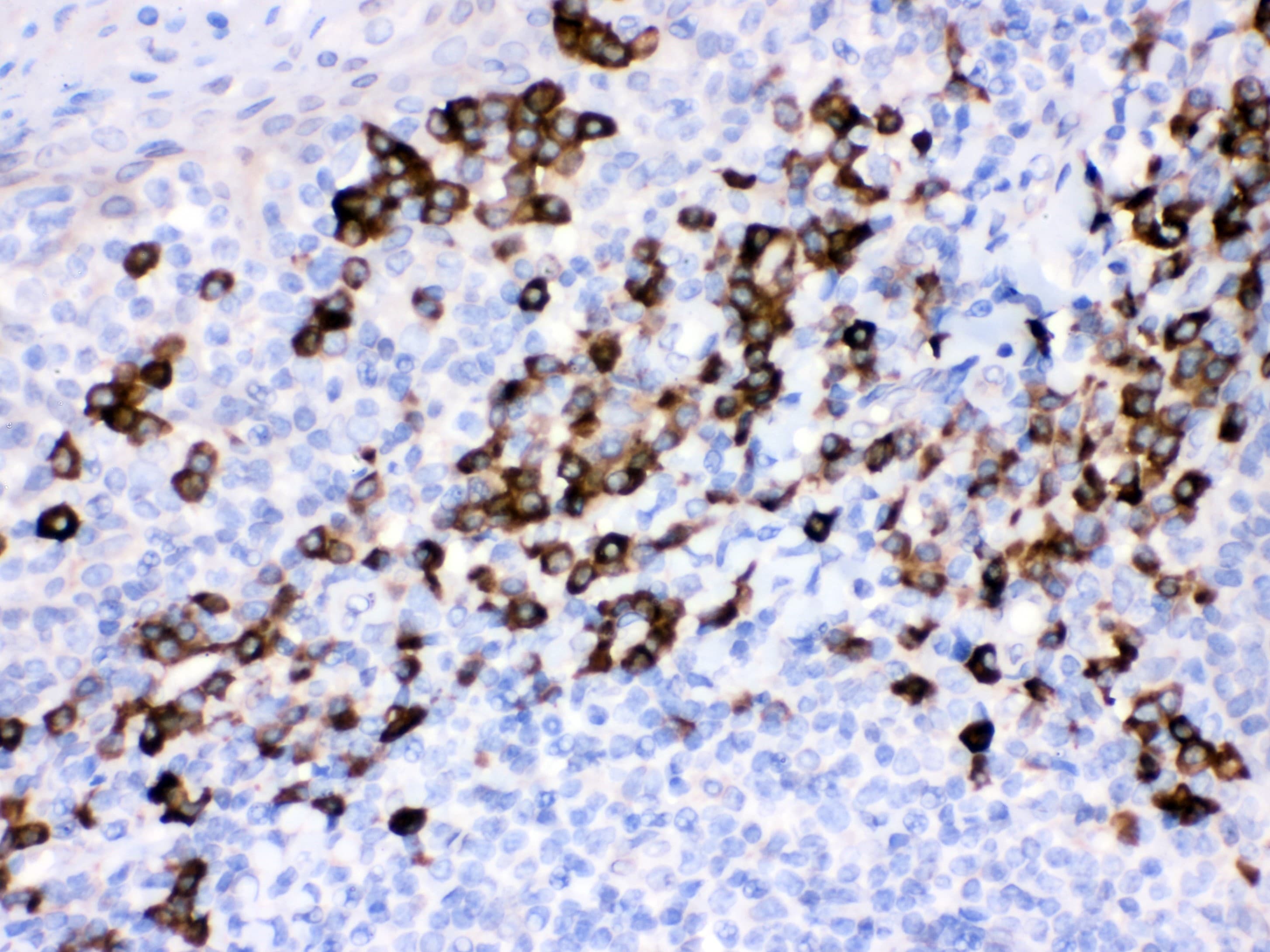 Polyclonal Rabbit anti-Human PRDX4 / Peroxiredoxin 4 Antibody (aa178-2081, IHC, WB)