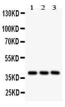 Polyclonal Rabbit anti-Human PTGER2 / EP2 Antibody (aa281-308, WB)