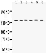 ROCK2 Antibody (aa652-923)