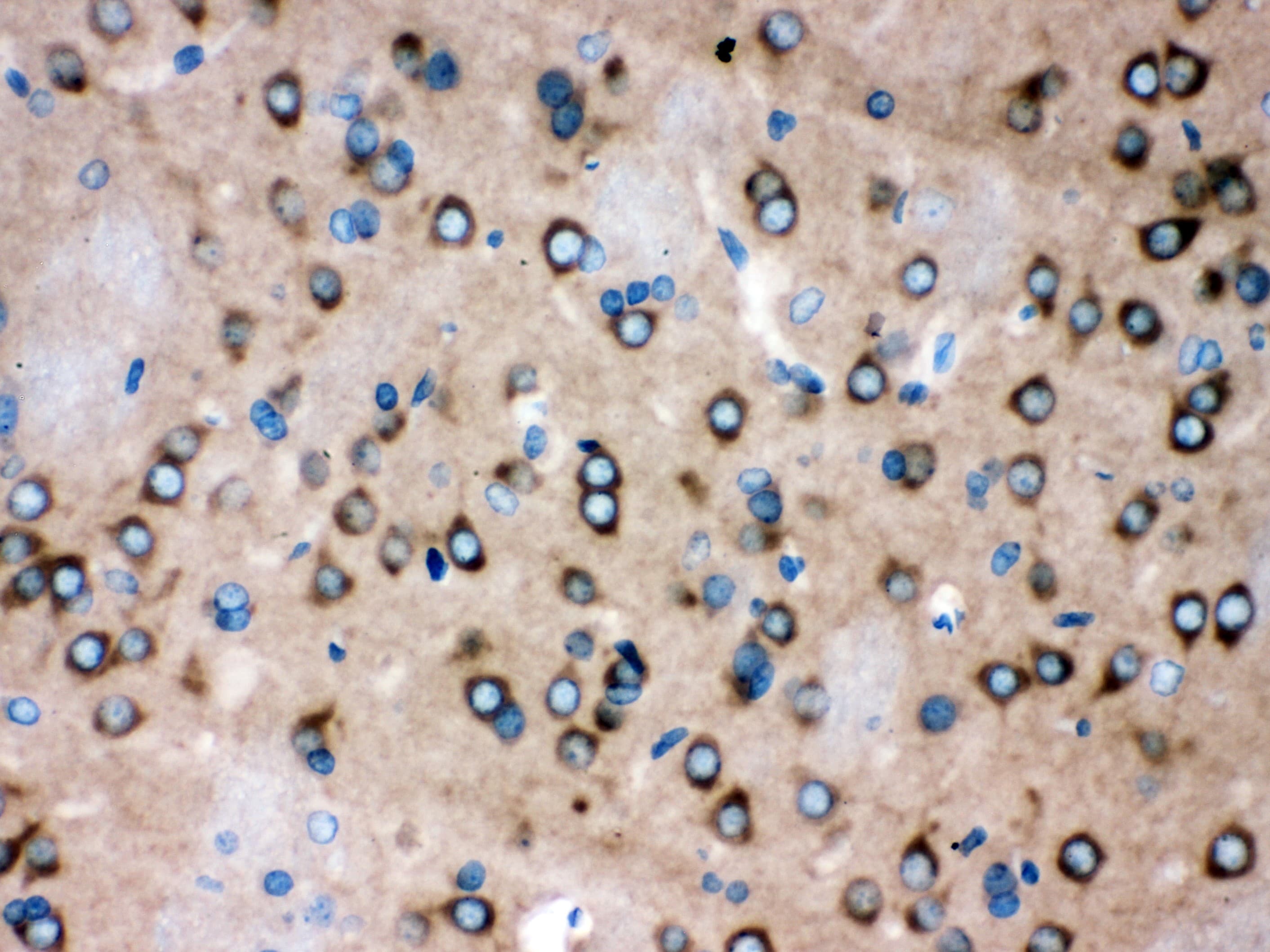 ROCK2 Antibody (aa652-923)
