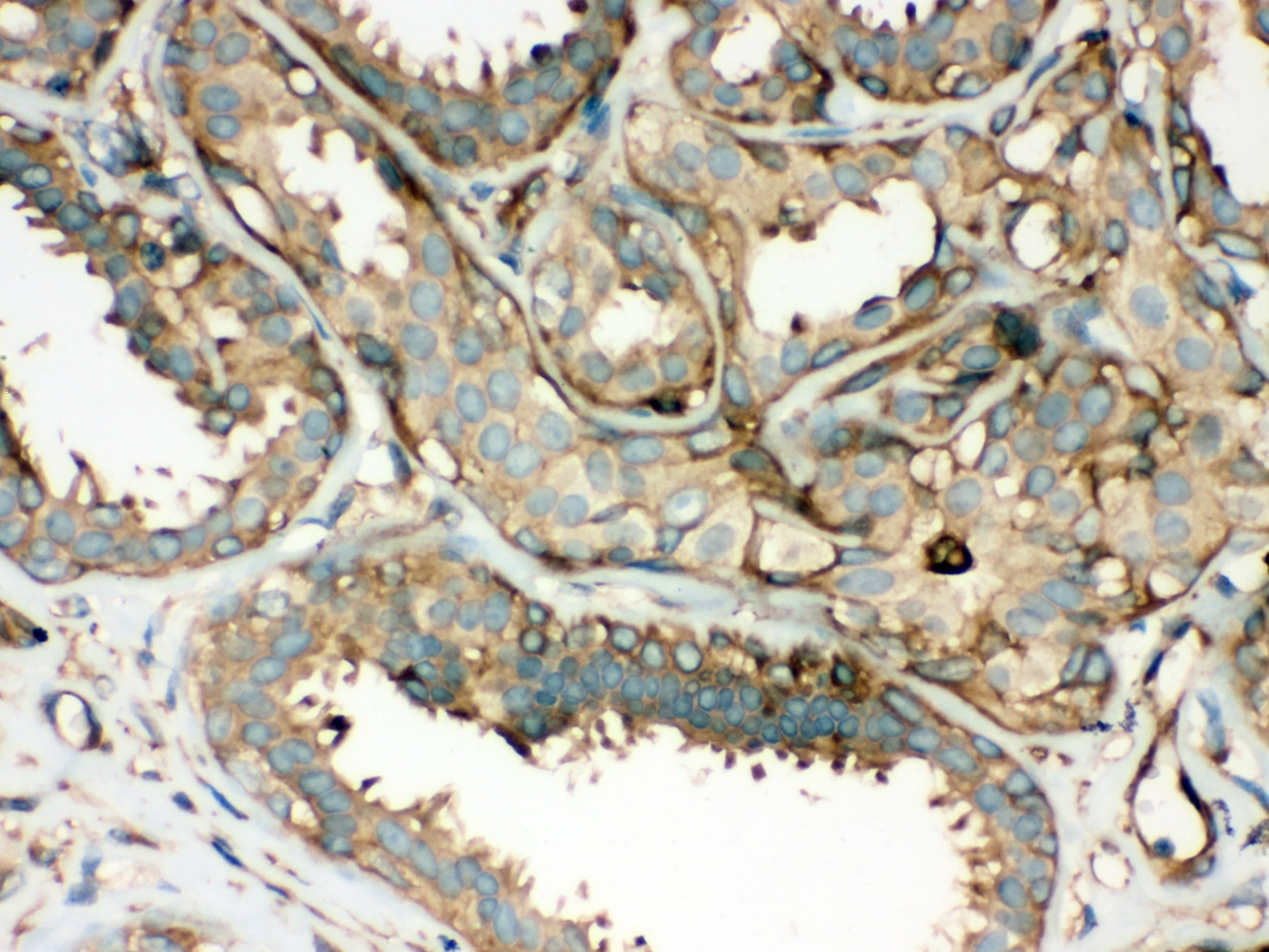 ROCK2 Antibody (aa652-923)