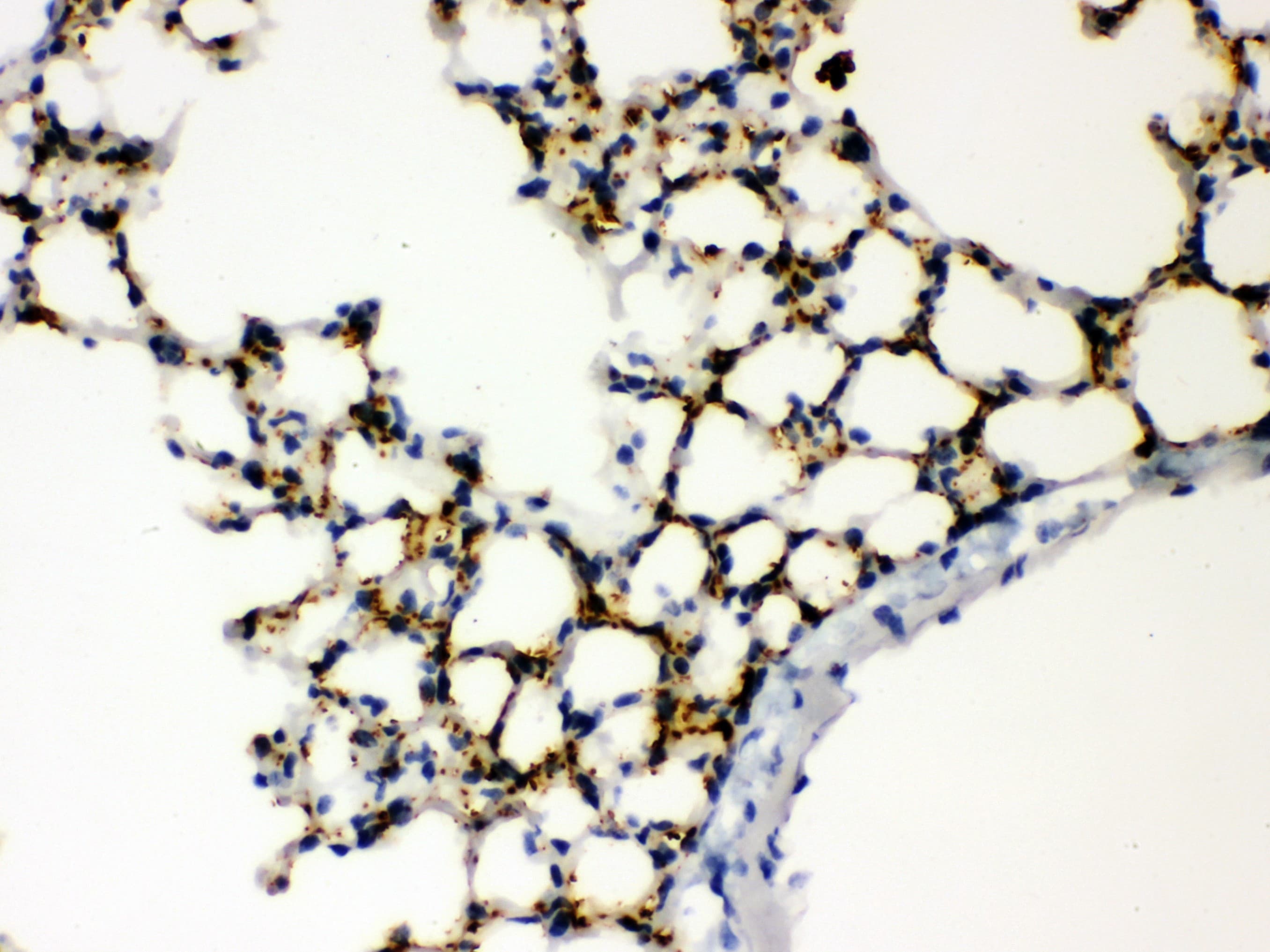 Polyclonal Rabbit anti-Human SFTPA1 + SFTPA2 Antibody (aa206-237, IHC, WB)