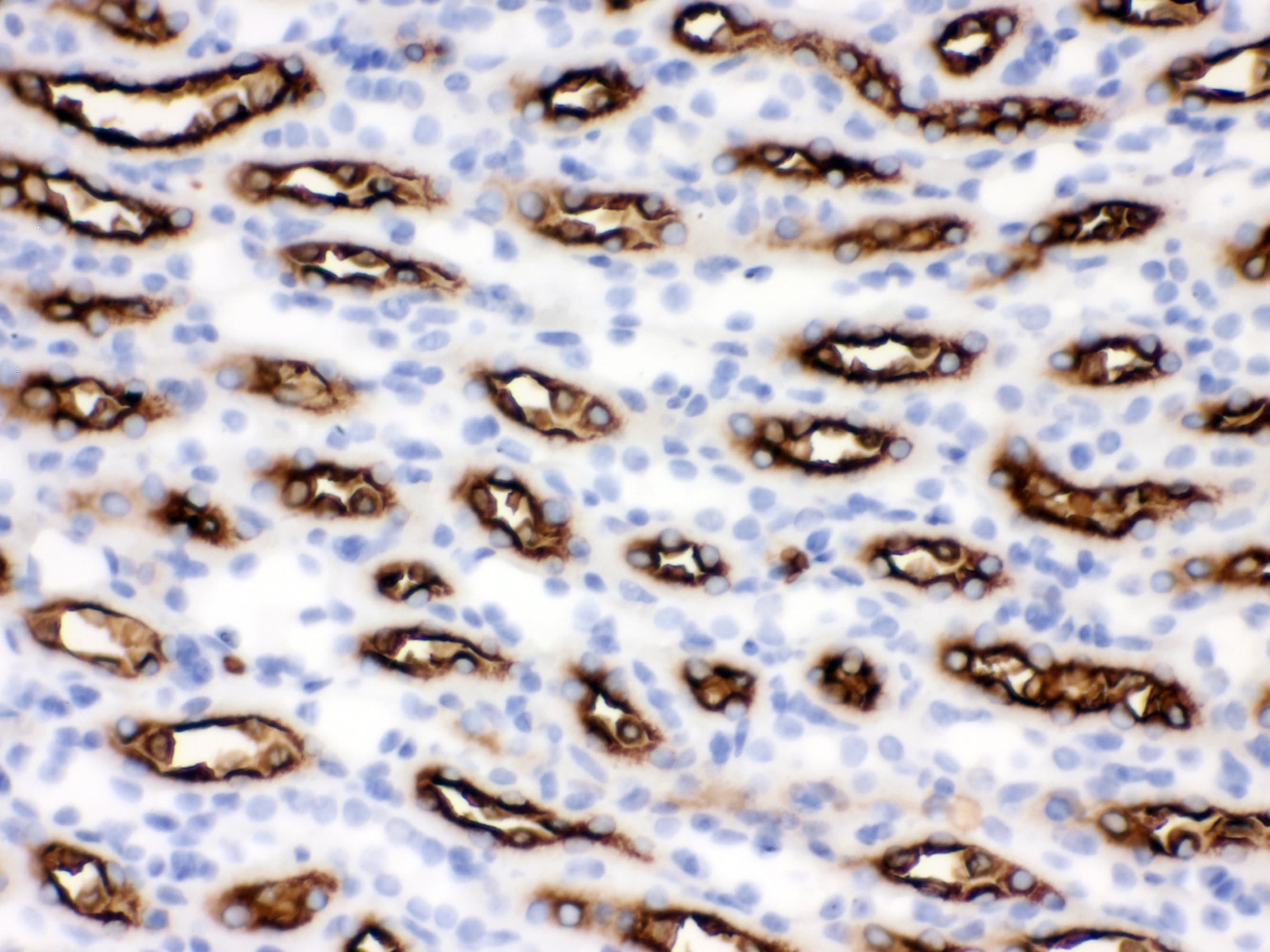 Polyclonal Rabbit anti-Human SLC12A1 / NKCC2 Antibody (aa52-83, IHC, WB)