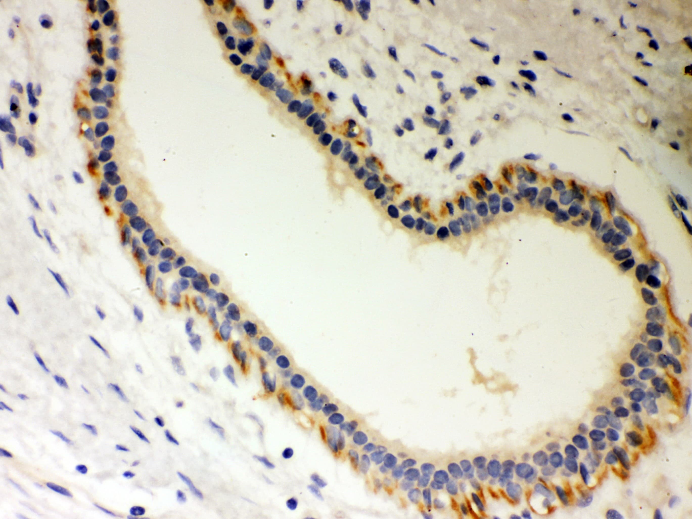 Polyclonal Rabbit anti-Human STRAP / MAWD Antibody (aa78-104, IHC, WB)