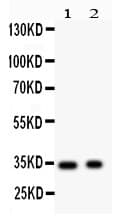 Polyclonal Rabbit anti-Human SYP / Synaptophysin Antibody (aa1-26, WB)