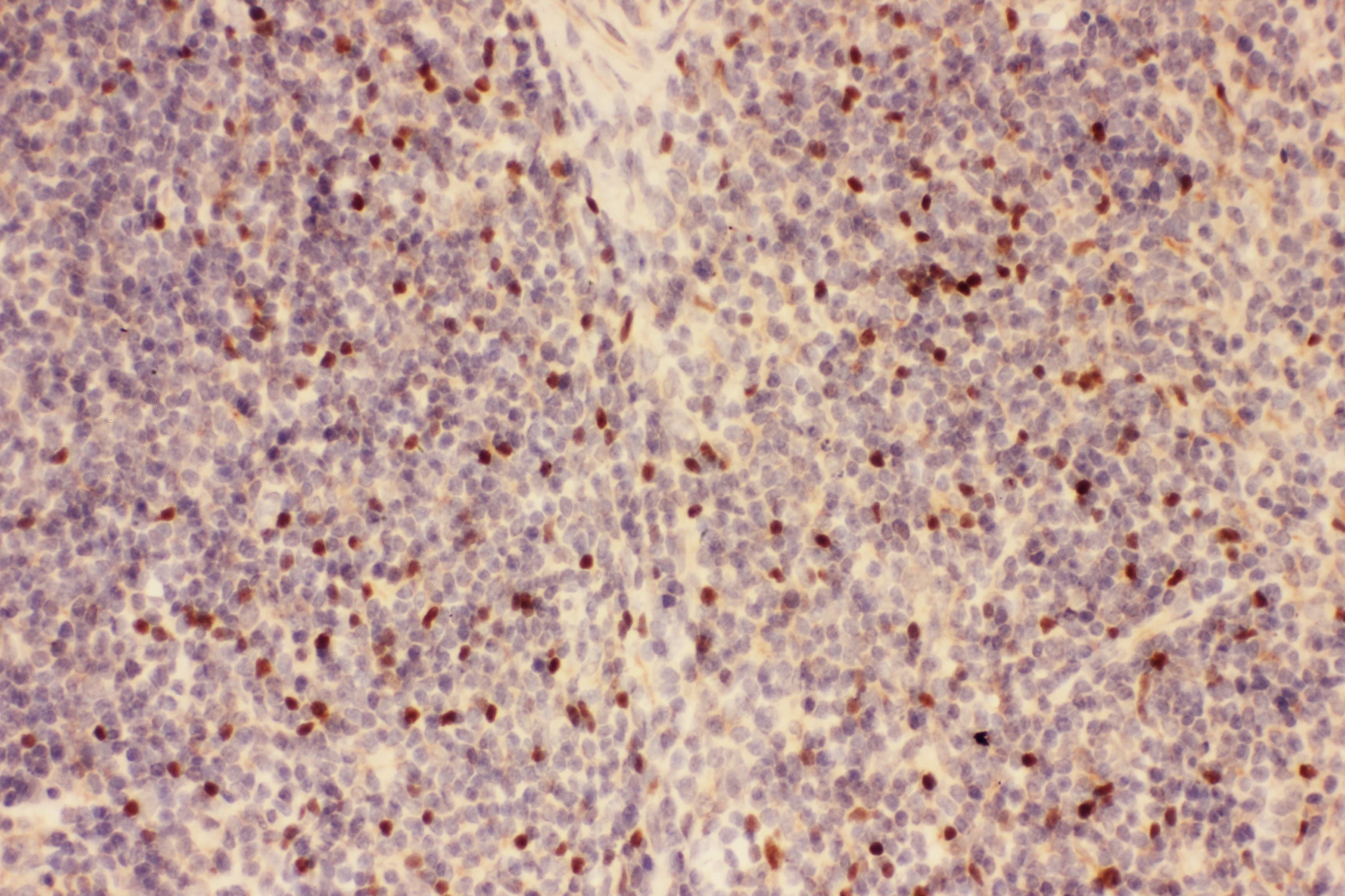 Polyclonal Rabbit anti-Human FOXP3 Antibody (aa101-431, IHC)