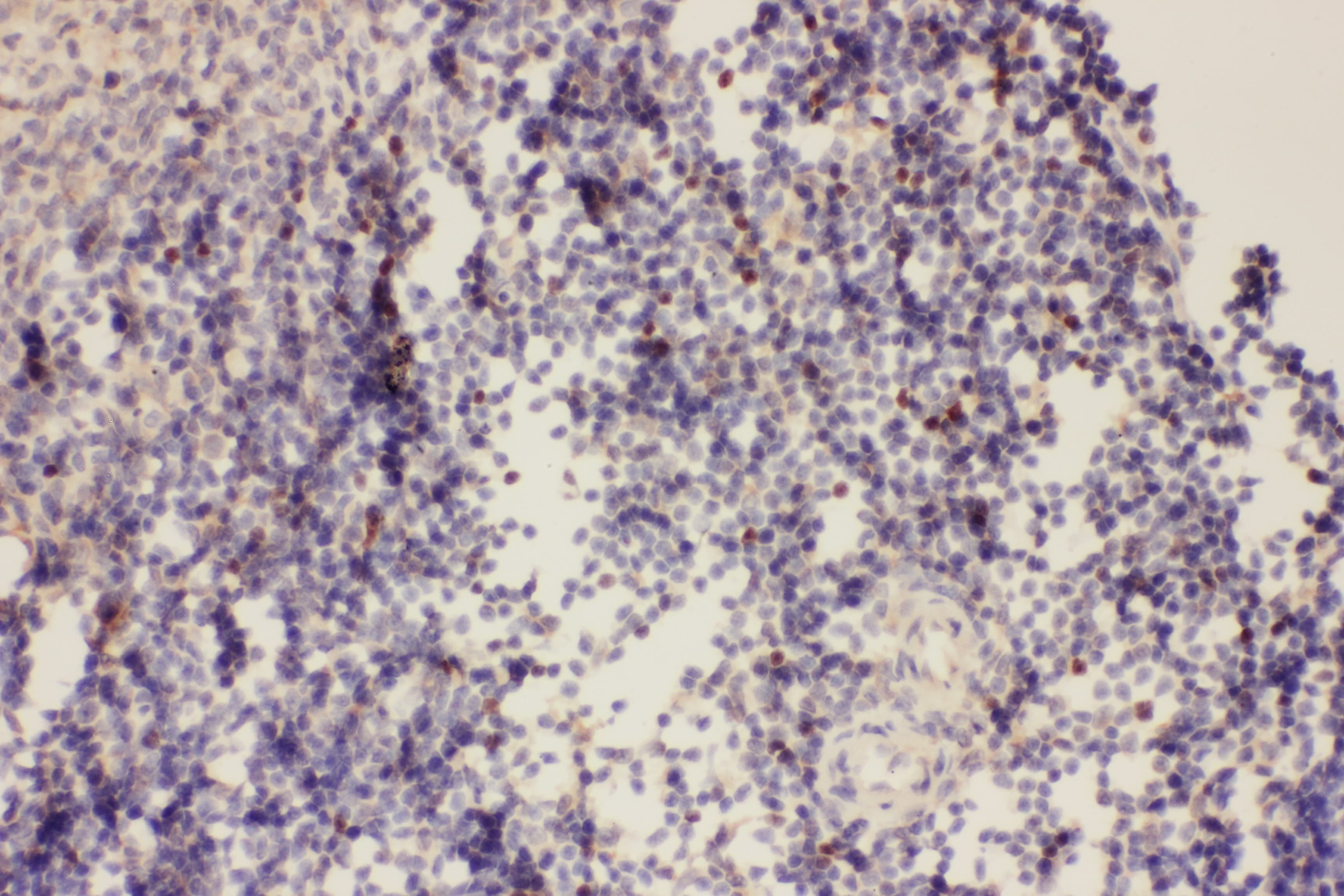 Polyclonal Rabbit anti-Human FOXP3 Antibody (aa101-431, IHC)