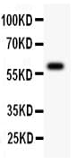 Polyclonal Rabbit anti-Human ATM Antibody (aa2870-3056, WB)