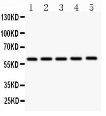 Polyclonal Rabbit anti-Human CBS Antibody (aa331-551, IHC, WB)