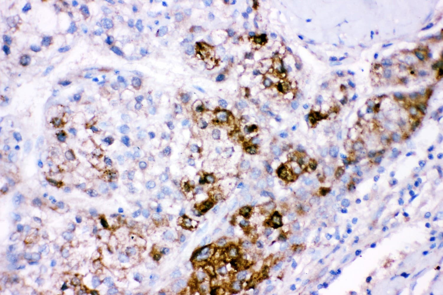 Polyclonal Rabbit anti-Human CBS Antibody (aa331-551, IHC, WB)