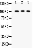 Polyclonal Rabbit anti-Human MCAM / CD146 Antibody (aa59-401, IHC, WB)