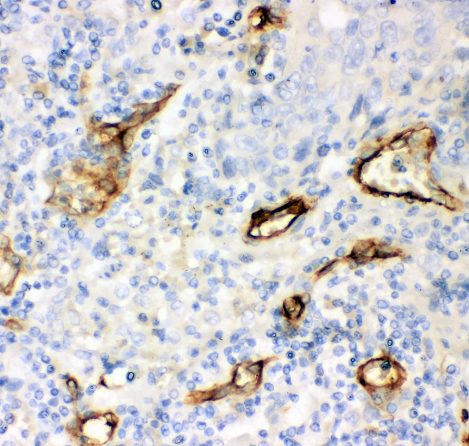 Polyclonal Rabbit anti-Human MCAM / CD146 Antibody (aa59-401, IHC, WB)