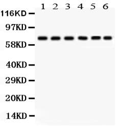 PRKCD / PKC-Delta Antibody (aa1-160)