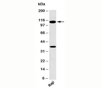 Monoclonal Mouse anti-Human TLR9 Antibody (clone TR9541, N-Terminus, IHC, WB)