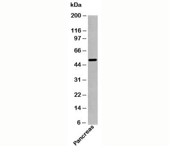 Polyclonal Rabbit anti-Human SGK1 / SGK Antibody (C-Terminus, WB)