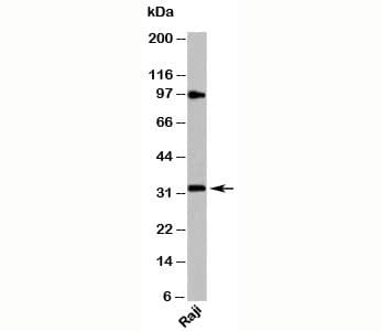 Polyclonal Rabbit anti-Human MYD88 Antibody (C-Terminus, WB)