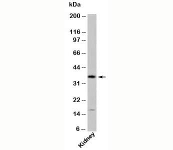 Polyclonal Rabbit anti-Human MLST8 / GBL Antibody (Internal, WB)