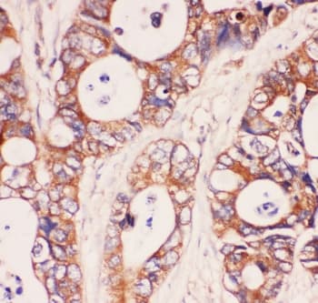 Polyclonal Rabbit anti-Human MYD88 Antibody (IHC, WB)