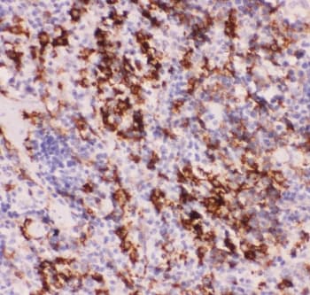 Polyclonal Rabbit anti-Human MYD88 Antibody (IHC, WB)
