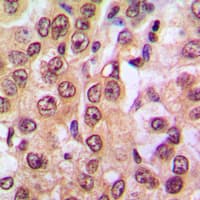 PTEN Antibody (C-Terminus)