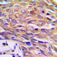 Polyclonal Rabbit anti-Human PTGES3 / p23 Antibody (Internal, IHC, WB)