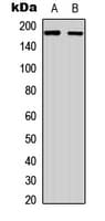 Polyclonal Rabbit anti-Human RET Antibody (C-Terminus, IHC, IF, WB)