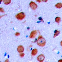 Polyclonal Rabbit anti-Human RET Antibody (C-Terminus, IHC, IF, WB)
