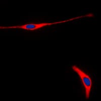 Polyclonal Rabbit anti-Human RET Antibody (C-Terminus, IHC, IF, WB)