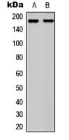 Polyclonal Rabbit anti-Human RET Antibody (pY1062 C-Terminus , IHC, IF, WB)
