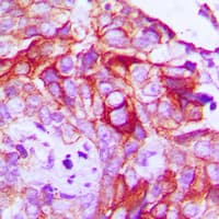 Polyclonal Rabbit anti-Human RET Antibody (pY1062 C-Terminus , IHC, IF, WB)