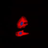 Polyclonal Rabbit anti-Human RET Antibody (pY1062 C-Terminus , IHC, IF, WB)