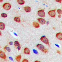 Polyclonal Rabbit anti-Human RTN4 / Nogo Antibody (Internal, IHC, WB)
