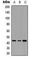 SERPINB3+4 Antibody (Internal)