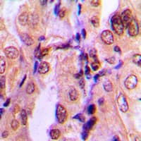 SMAD2 Antibody (C-Terminus)