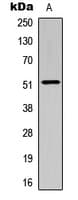 Polyclonal Rabbit anti-Human SMAD3 Antibody (Internal, IHC, IF, WB)