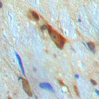 Polyclonal Rabbit anti-Human SMAD3 Antibody (Internal, IHC, IF, WB)