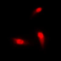Polyclonal Rabbit anti-Human SMAD3 Antibody (Internal, IHC, IF, WB)
