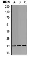 STMN1 / Stathmin / LAG Antibody (N-Terminus)
