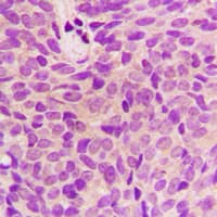 STMN1 / Stathmin / LAG Antibody (N-Terminus)