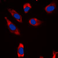 STMN1 / Stathmin / LAG Antibody (N-Terminus)
