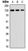 Polyclonal Rabbit anti-Human THBS2 / Thrombospondin 2 Antibody (C-Terminus, WB)