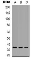 Polyclonal Rabbit anti-Human TNFSF10 / TRAIL Antibody (Internal, WB)